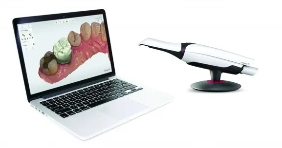 Intraoralscanner mit Laptop zur digitalen Zahnabformung